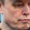 Mata Elon Musk Lebam Saat Pamitan ke Donald Trump